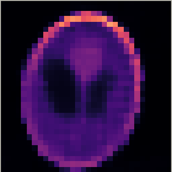 Sparse-view CT reconstruction